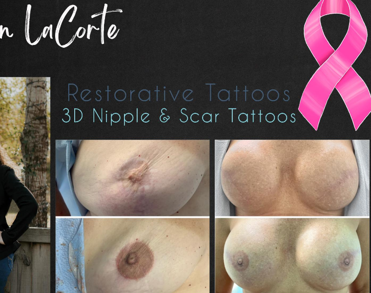 For Breast Cancer Awareness Month, Helping Those Who Help Patients